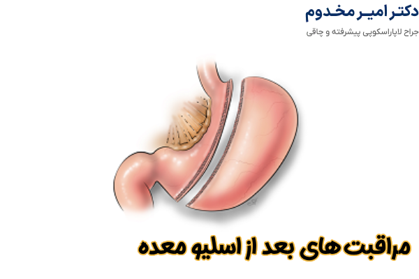 مراقبت های بعد از اسلیو