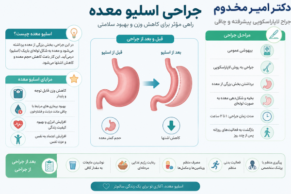قیمت اسلیو معده