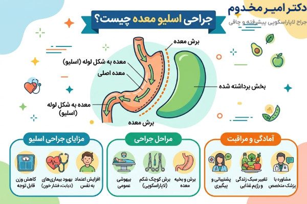 اسلیو معده چیست