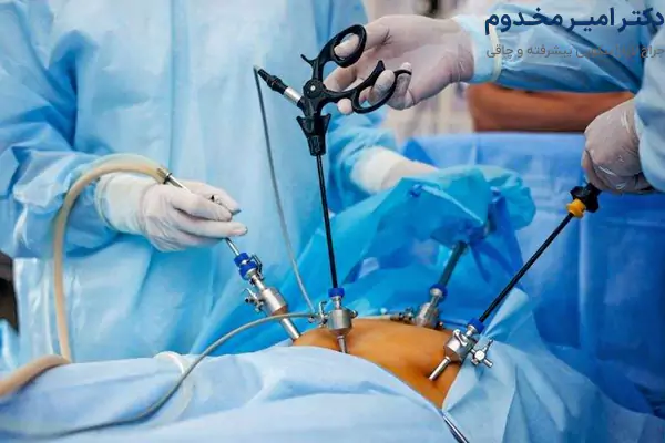 جراحی لاپاراسکوپی دستگاه گوارش