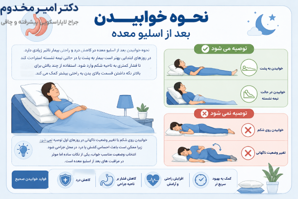 نحوه خوابیدن بعد اسلیو معده